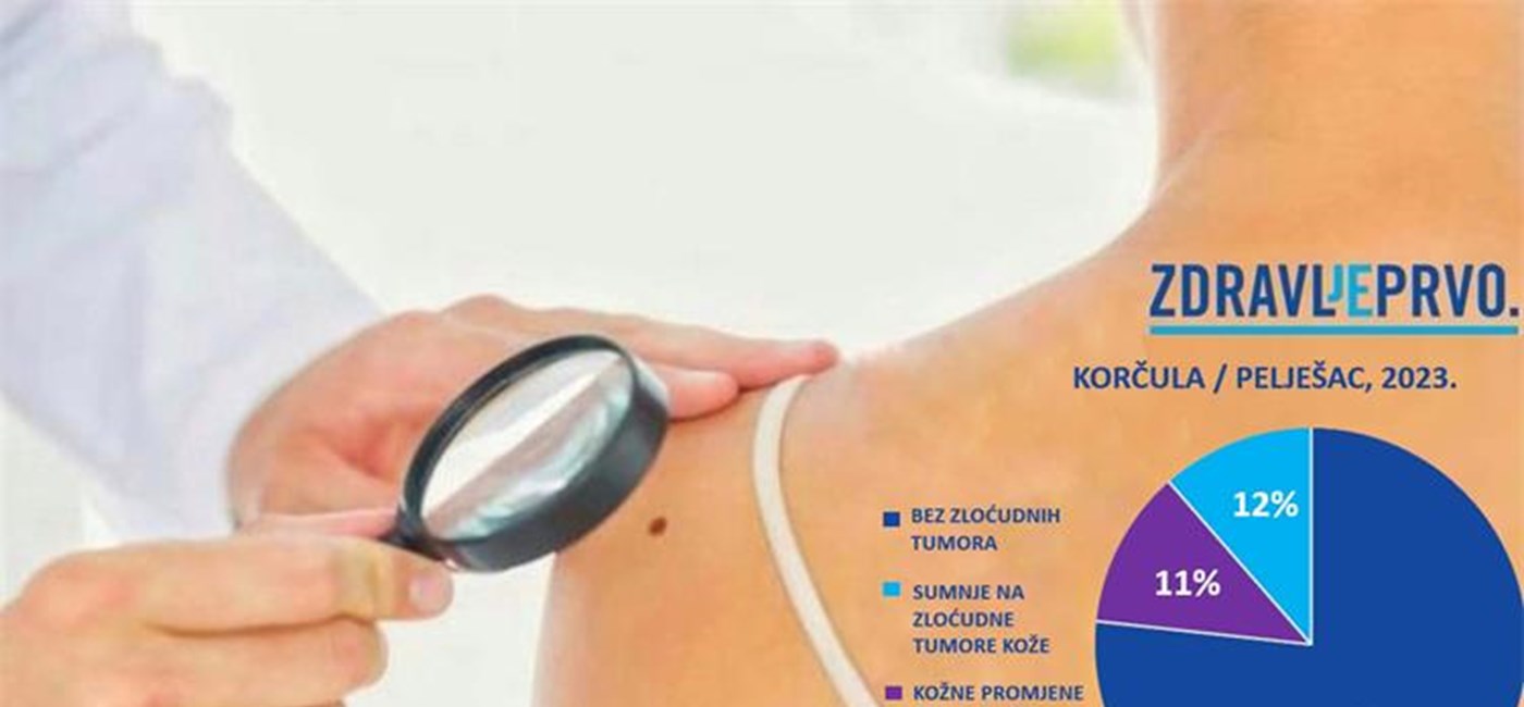 Beroš: Više od 10 posto sumnji na malignu bolest kože na Korčuli i Pelješcu razlog više za preventivne preglede